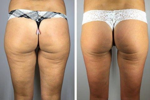 Before and After 6