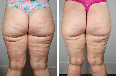 Before and After 5