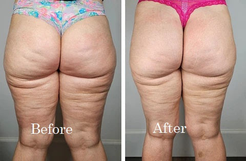 Before and After 2