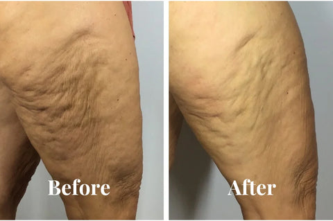 Before and After 7
