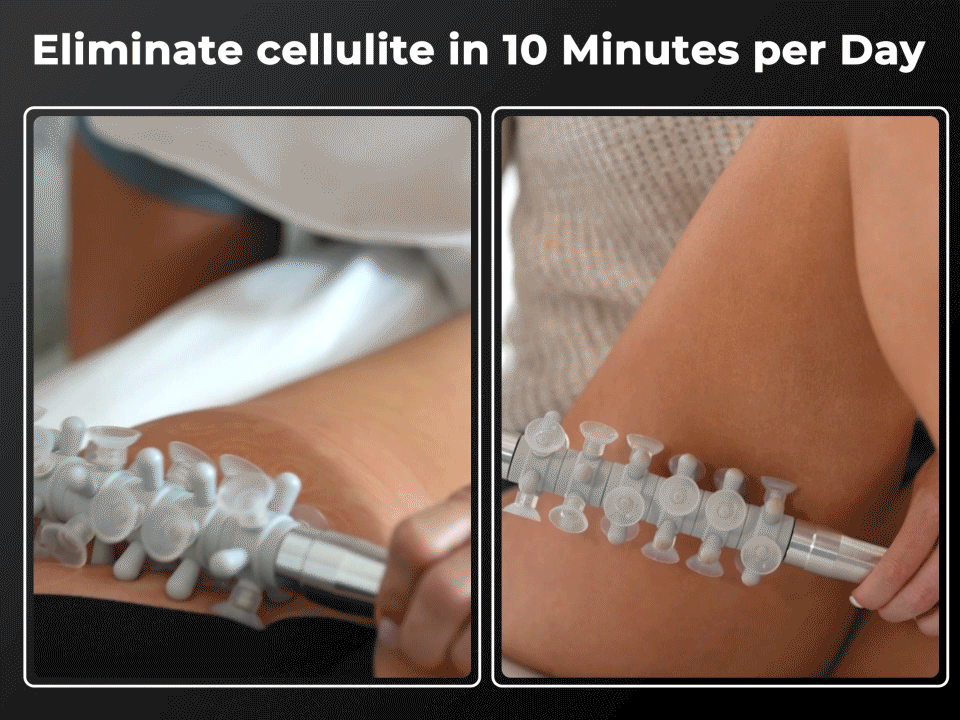 THE MOST EFFECTIVE FASCIA ROLLER ON THE MARKET