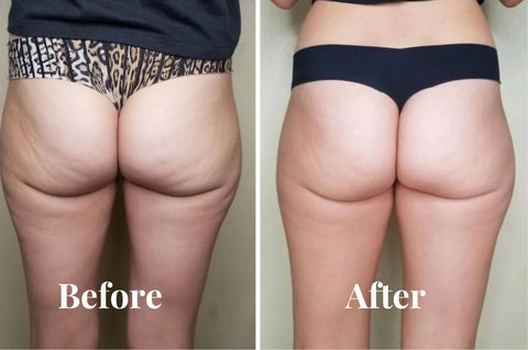Before and After 6