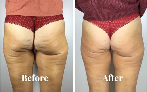 Before and After 5
