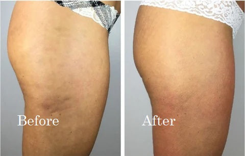 Before and After 1