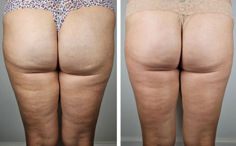 Before and After 4