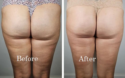 Before and After 3
