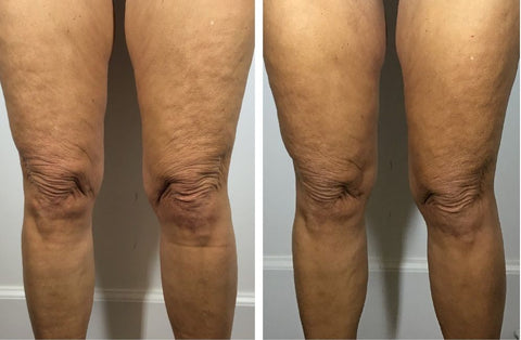 Before and After 7