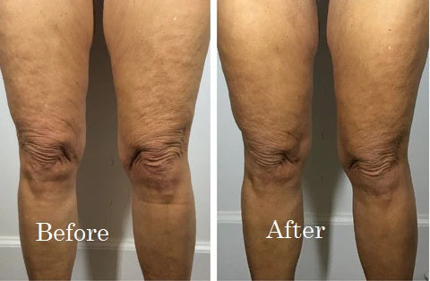Before and After 4